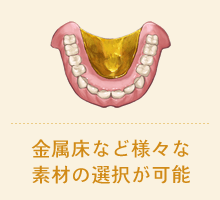 金属症など様々な素材の選択が可能