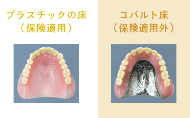 プラスチックの床（保険適用）　コバルト床（保険適用外）