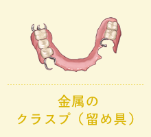 金属のクラスプ（留め具）