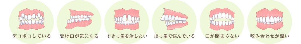 「デコボコしている」「受け口が気になる」「すきっ歯を治したい」「出っ歯で悩んでいる」「口が閉まらない」「咬み合わせが深い」